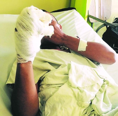 Un joven de Intibucá, es el primer quemado por pólvora