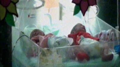 Los trillizos nacieron tras una operación cesárea y se encuentran en condición estable, informó el centro hospitalario.