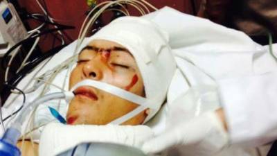 Hondureño que se encuentra grave en el Estado de Hidalgo.