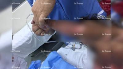 Las primeras 72 horas luego de la quemadura son cruciales para su recuperación.