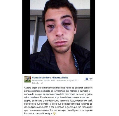 Joven publica golpiza que recibió de su exnovia