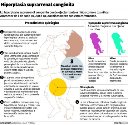 En el Mario Rivas operan a niñas que nacen con genitales ambiguos