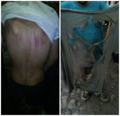 Joven muere tras caerle rayo en Santa Bárbara