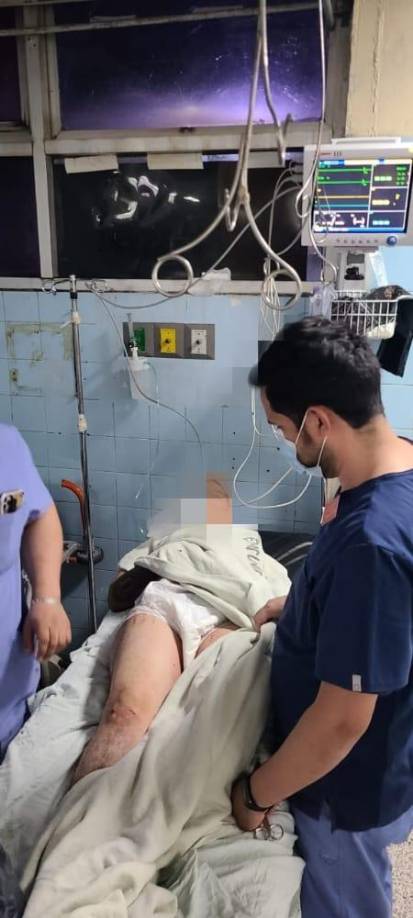 El detenido sufrió heridas en el enfrentamiento con los policías. Otro hombre resultó herido en el cruce de disparos. 