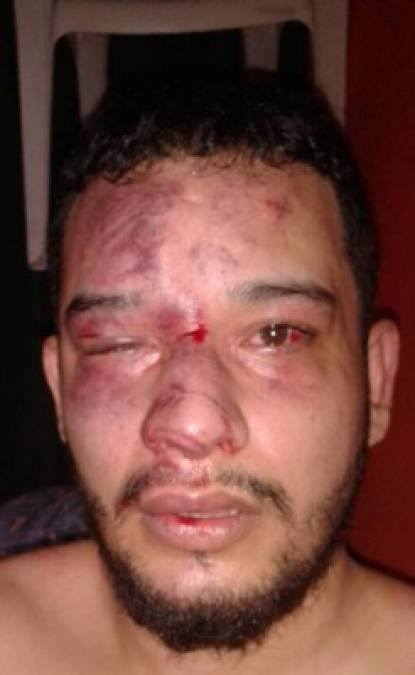 Nieto denuncia torturas que incluían golpizas, choques eléctricos o asfixia con bolsas impregnadas de insecticida.<br/><br/>Rodolfo González, un piloto detenido en las manifestaciones de 2014, se ahorcó allí en marzo de 2015.