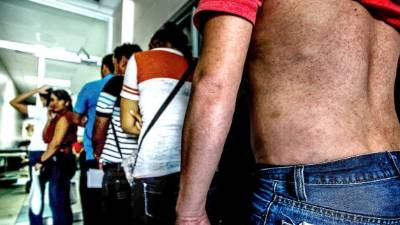 Cada vez es mayor el número de pacientes atendidos por zika en el hospital Mario Rivas.