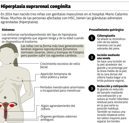 En el Mario Rivas operan a niñas que nacen con genitales ambiguos