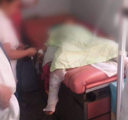 Niño sufre graves quemaduras tras caer en olla de masa para tamales