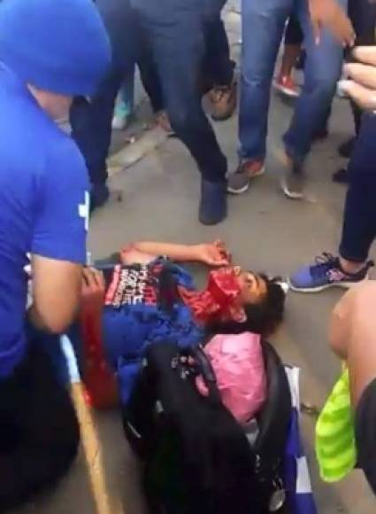 Usuarios en redes sociales compartieron imágenes de la masacre en pleno centro de Managua.