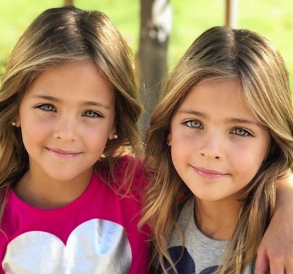 Las gemelas más bellas del mundo