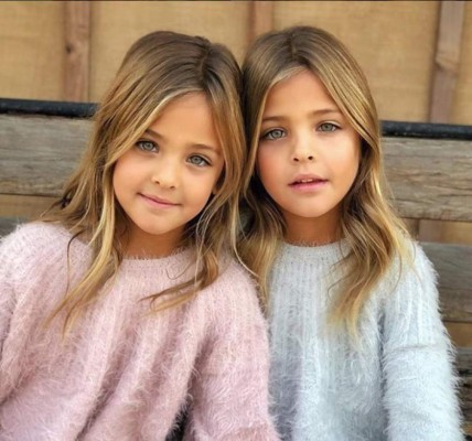 Las gemelas más bellas del mundo
