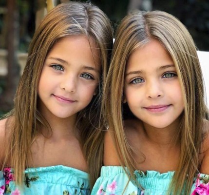 Las gemelas más bellas del mundo