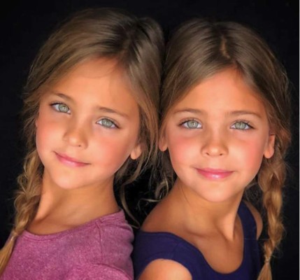 Las gemelas más bellas del mundo