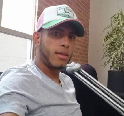 Eddie Hernández se lesiona del tobillo en Colombia