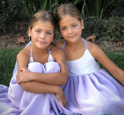 Las gemelas más bellas del mundo