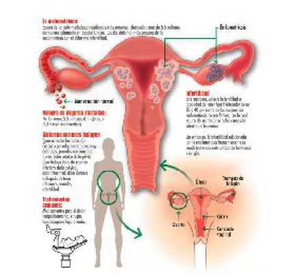 Un mal de todos los meses