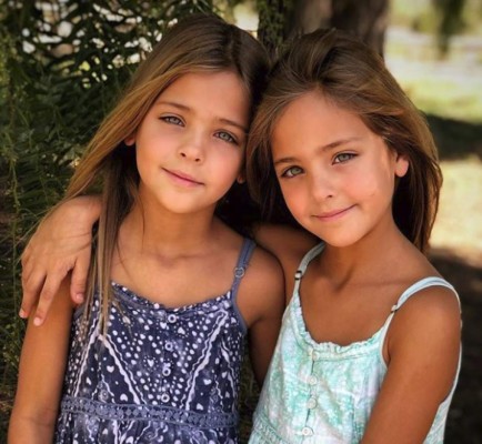 Las gemelas más bellas del mundo