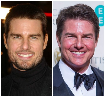 ¿Qué se hizo Tom Cruise en la cara?