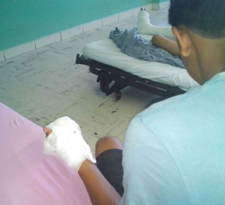 Ingresa al hospital Mario Rivas un joven quemado por pólvora