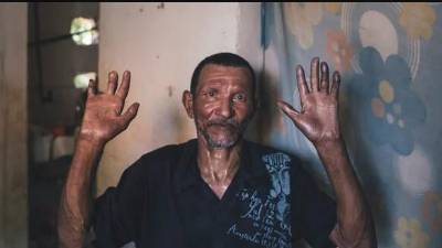 Se sabe que también hay casos en otros departamentos.