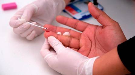 El “paciente de Ginebra” muestra signos de remisión del VIH tras una innovadora cirugía.