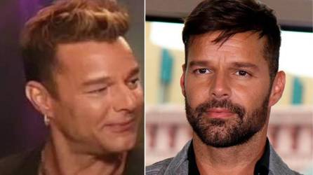 Los memes tras el retoque facial que se hizo el artista Ricky Martin no se han hecho esperar. En redes sociales circulan los fans se han dado la tarea de demostrar que el famoso no necesitaba pasar por el bisturí.