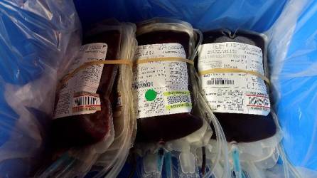 Las autoridades sanitarias de Nueva Zelanda no distinguen en sus bancos de sangre si los donantes fueron vacunados o no contra el covid 19.