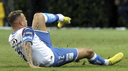El defensor brasileño Gustavo Ferrareis del Publa sufrió una espeluznante lesión en el duelo ante las Chivas por la jornada 14 de la Liga MX.