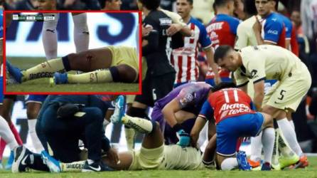 Giovani dos Santos sufrió una horrible lesión en su pierna derecha.