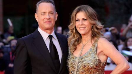 Tom Hanks reveló que su esposa Rita Wilson sufrió los síntomas más graves del COVID-19.