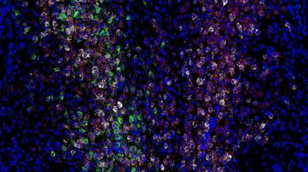 Expresión de varios genes y proteínas (blanco, rojo y verde) en las neuronas entre las células cerebrales de los ratones (azul).