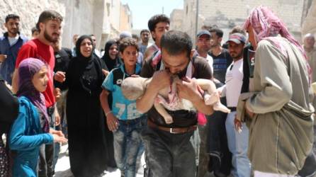 Un alto porcentaje de niños han sido víctimas de los ataques del régimen y de las fuerzas rebeldes. Fotos: AFP