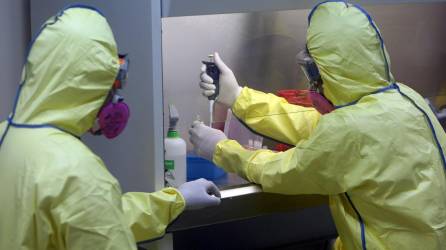 El jueves, la Agencia de Sanidad Pública de Canadá (PHAC) y el Ministerio de Sanidad de Quebec confirmaron los dos primeros casos de la viruela del mono en el país norteamericano. Fotografía: EFE