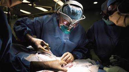 Cirujanos estadounidenses lograron realizar con éxito un segundo trasplante de riñón de cerdo en un humano.