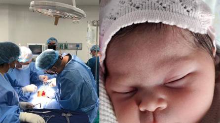 Nace la primera bebé “in vitro” asistida con inteligencia artificial en Honduras