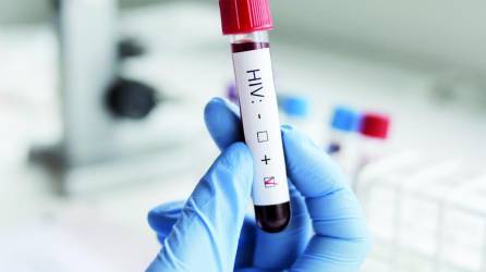 <b>En el Mario Catarino Rivas, las pruebas en sangre VIH son gratuitas así como tratamiento.</b>