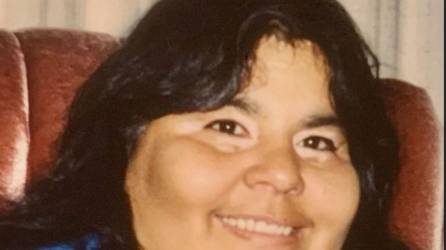 Joanne Aguilar, de 66 años y residente en el condado californiano de Ventura, pasó 10 días en el hospital tras el accidente.