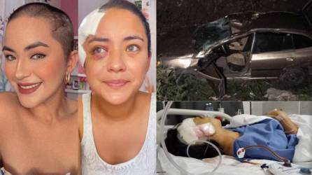 Iris Portillo, modelo y periodista, sufrió un accidente de tránsito cerca del mall Las Américas de Choloma, Cortés el pasado 29 de junio. La joven perdió el control de su vehículo y cayó en una hondonada.