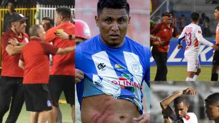 Las imágenes más curiosas que dejó el inicio de la jornada 6 del Clausura 2024 de la Liga Nacional de Honduras.