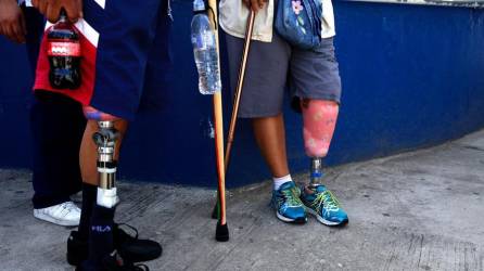 Pacientes con prótesis colocadas en el mes de julio realizan sus primeras terapias y prácticas para adaptarse, en el Instituto Guatemalteco de Seguridad Social.