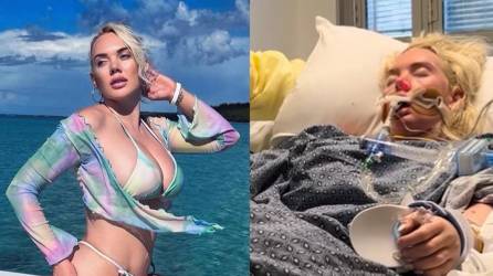 La modelo estadounidense Jennifer Barlow se infectó con la bacteria tras sufrir un corte durante sus vacaciones en Bahamas.