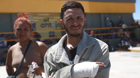 El migrante venezolano Carlos Meza muestra su mano lesionada, el 15 de Abril de 2024, mientras permanece con su familia en un campamento improvisado en Chihuahua.