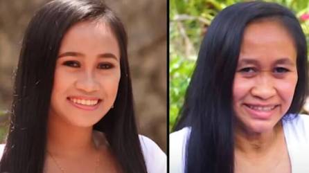 Raizel Calago, una adolescente filipina de 16 años de edad, “envejeció” unos 30 años en pocas semanas tras ser diagnosticada con un extraño trastorno genético, informaron medios internacionales.