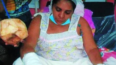 Rosaura Herrera se encuentra interna en el Hospital del Sur en proceso de recuperación, pero sin sus dos manos.