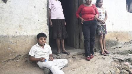 Familias enteras en el área rural de lempira sufren desnutrición por crisis alimentaria.