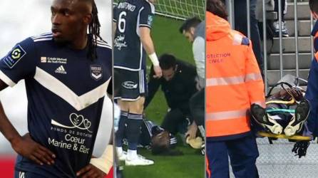 El hondureño Alberth Elis recibió este sábado un fuerte golpe en la cabeza con un adversario, quedó inconsciente y tuvo que ser retirado en camilla ante la preocupación de los jugadores del Girondins de Burdeos.