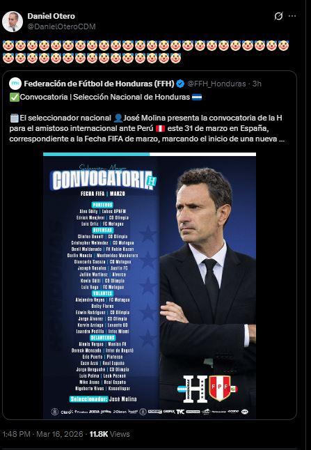 Esto dicen tras primera convocatoria de Molina y Otero deja polémica reacción