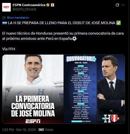 Esto dicen tras primera convocatoria de Molina y Otero deja polémica reacción