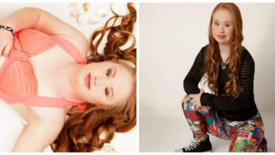 La modelo Madeline Stuart.