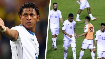 Carlo Costly habló de la nueva derrota que sufrió Honduras contra Canadá.